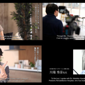 5本指じゃない人間は、AIにとってエラー？ 思いがけず浮かび上がらせた裂手症の事例からAI時代の問いを考える